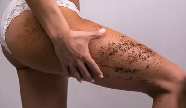 Премахване на целулит