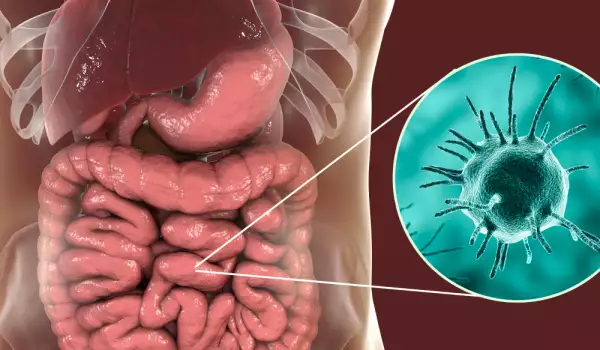 Как да изчистим паразитите от тялото?