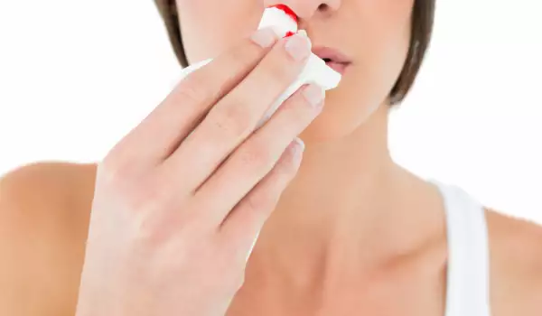 Как да спрем кръв от носа
