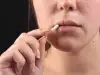 Народна медицина при херпес